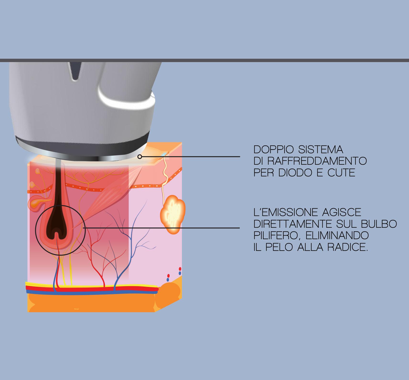 laser-manipolo
